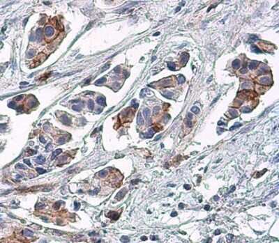 Immunohistochemistry-Paraffin: EGFR [p Tyr1148] Antibody [NBP3-13231]